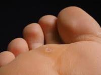Chesterfield Podiatry image 4